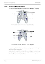 Preview for 72 page of BeneVision TMS60 Operator'S Manual