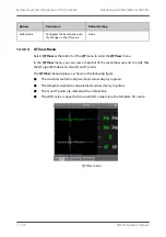 Preview for 158 page of BeneVision TMS60 Operator'S Manual