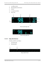 Preview for 171 page of BeneVision TMS60 Operator'S Manual