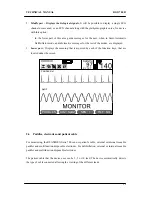 Предварительный просмотр 39 страницы Bexen Reanibex 700 Technical Manual