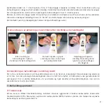 Preview for 37 page of Biocare B-Cure Laser Sport Instructions For Use Manual