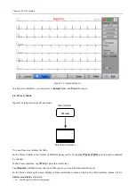 Preview for 46 page of Biocare iE 101 User Manual