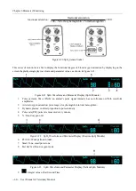 Предварительный просмотр 72 страницы Biocare iM 12 User Manual