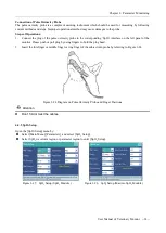 Предварительный просмотр 75 страницы Biocare iM 12 User Manual