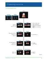 Предварительный просмотр 39 страницы Biolase Waterlase iPlus User Manual