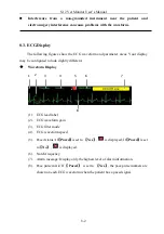 Preview for 76 page of Biolight Meditech S12 Vet Manual