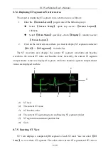 Preview for 94 page of Biolight Meditech S12 Vet Manual