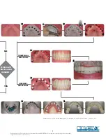 Предварительный просмотр 5 страницы Biomet 3i Navigator Procedures Manual