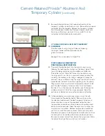 Предварительный просмотр 24 страницы Biomet 3i Navigator Procedures Manual