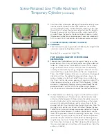 Предварительный просмотр 26 страницы Biomet 3i Navigator Procedures Manual