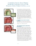 Предварительный просмотр 30 страницы Biomet 3i Navigator Procedures Manual