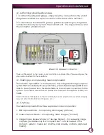 Preview for 19 page of BIOMET OnPoint Operation And Care Manual