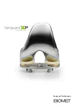 BIOMET VANGUARD XP Manual preview