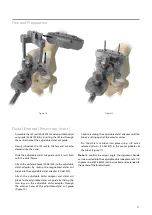 Предварительный просмотр 13 страницы BIOMET VANGUARD XP Manual