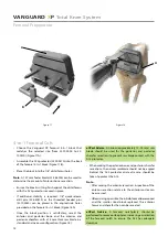 Предварительный просмотр 16 страницы BIOMET VANGUARD XP Manual