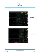 Предварительный просмотр 76 страницы Bionet BM Elite Series Instructions For Use Manual