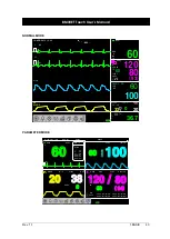Предварительный просмотр 43 страницы Bionet BM3VET Touch User Manual