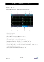 Предварительный просмотр 23 страницы Bionet CardioTouch3000 Operation Manual