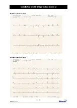 Предварительный просмотр 48 страницы Bionet CardioTouch3000 Operation Manual