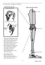 Preview for 17 page of Blatchford 4 Bolt ESK+ 239150 Manual