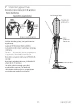 Preview for 145 page of Blatchford ESK+ 4-Bolt Instructions For Use Manual