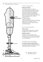 Preview for 19 page of Blatchford Esprit ESP22L1S Instructions For Use Manual