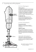 Preview for 79 page of Blatchford Esprit ESP22L1S Instructions For Use Manual