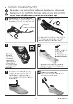 Preview for 81 page of Blatchford Esprit ESP22L1S Instructions For Use Manual