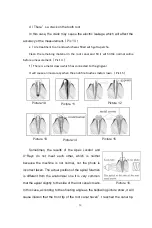 Предварительный просмотр 17 страницы Bomedent iRoot apex Operation Manual