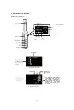 Preview for 12 page of Bomedent iRoot pro Operation Manual