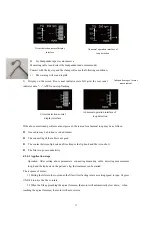 Preview for 19 page of Bomedent iRoot pro Operation Manual