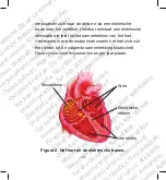 Preview for 29 page of Boston Scientific EMBLEM S-ICD Handbook