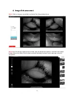 Preview for 17 page of BoX Medical Solutions Meibox User Manual