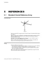 Предварительный просмотр 53 страницы Brainlab CRANIAL/ENT OPTICAL TRACKING Instrument User Manual