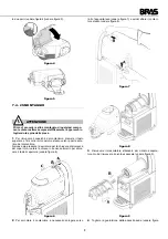 Preview for 9 page of Bras B-cream HD Operator'S Manual