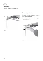 Предварительный просмотр 148 страницы Braun Aescualp MINOP inVent trocar 30 Instructions For Use Manual