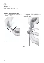 Предварительный просмотр 256 страницы Braun Aescualp MINOP inVent trocar 30 Instructions For Use Manual