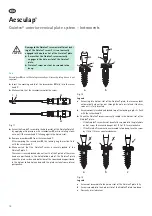 Предварительный просмотр 12 страницы Braun Aesculap Quintex Instructions For Use/Technical Description