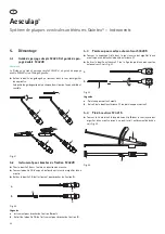 Предварительный просмотр 54 страницы Braun Aesculap Quintex Instructions For Use/Technical Description