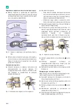 Предварительный просмотр 190 страницы Braun Aesculap TSPACE 3D Instructions For Use/Technical Description