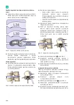 Предварительный просмотр 210 страницы Braun Aesculap TSPACE 3D Instructions For Use/Technical Description