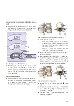 Предварительный просмотр 29 страницы Braun Aesculap TSPACE PEEK Instructions For Use/Technical Description