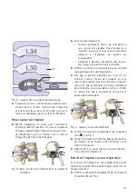 Предварительный просмотр 49 страницы Braun Aesculap TSPACE PEEK Instructions For Use/Technical Description