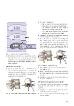 Предварительный просмотр 69 страницы Braun Aesculap TSPACE PEEK Instructions For Use/Technical Description