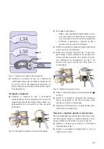 Предварительный просмотр 109 страницы Braun Aesculap TSPACE PEEK Instructions For Use/Technical Description