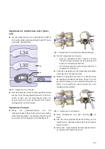 Предварительный просмотр 129 страницы Braun Aesculap TSPACE PEEK Instructions For Use/Technical Description