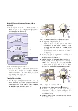 Предварительный просмотр 191 страницы Braun Aesculap TSPACE PEEK Instructions For Use/Technical Description