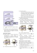 Предварительный просмотр 211 страницы Braun Aesculap TSPACE PEEK Instructions For Use/Technical Description