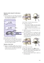 Предварительный просмотр 251 страницы Braun Aesculap TSPACE PEEK Instructions For Use/Technical Description