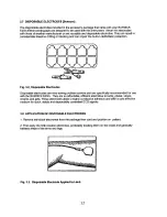 Предварительный просмотр 13 страницы Burdick E350i Operating Instructions Manual